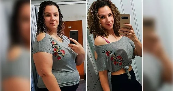 VittaBurn customer Sarah before and after photos